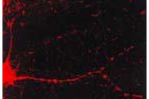 Immunofluorescence (IF) image for anti-Calcium/calmodulin-Dependent Protein Kinase II alpha (CAMK2A) antibody (ABIN6658151)
