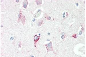 Human Brain, Cortex: Formalin-Fixed, Paraffin-Embedded (FFPE) (SRR 抗体)