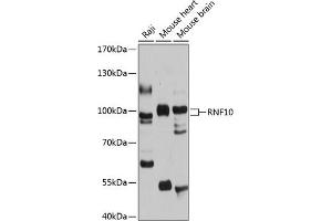 Western blot analysis of extracts of various cell lines, using RNF10 antibody (ABIN6128687, ABIN6147001, ABIN6147002 and ABIN6215902) at 1:1000 dilution. (RNF10 抗体  (AA 552-811))