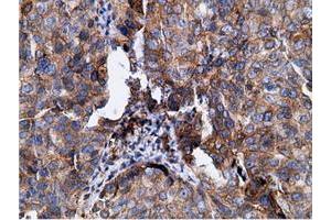 Immunohistochemical staining of paraffin-embedded Human colon tissue using anti-KHK mouse monoclonal antibody. (Ketohexokinase 抗体)