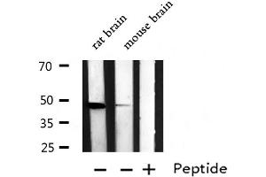 Western blot analysis of EDG2 expression in various lysates (LPAR1 抗体  (N-Term))