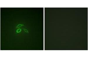 Immunofluorescence analysis of HepG2 cells, using CD227/MUC1 (Phospho-Tyr1229) Antibody. (MUC1 抗体  (pTyr1229))