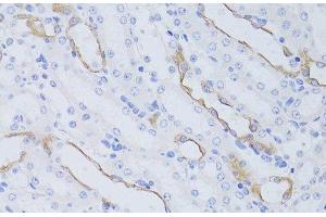 Immunohistochemistry of paraffin-embedded Mouse kidney using Aquaporin 4 Polyclonal Antibody at dilution of 1:50 (40x lens). (Aquaporin 4 抗体)