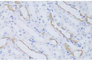 Immunohistochemistry of paraffin-embedded Mouse kidney using Aquaporin 4 Polyclonal Antibody at dilution of 1:50 (40x lens).