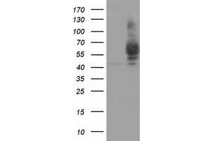 Western Blotting (WB) image for anti-Pantothenate Kinase 2 (PANK2) antibody (ABIN1500027) (PANK2 抗体)