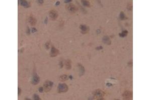 IHC-P analysis of Rat Tissue, with DAB staining. (SLIT2 抗体  (AA 209-374))