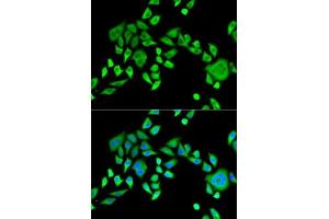 Immunofluorescence analysis of HeLa cells using SH3GL2 antibody (ABIN6132118, ABIN6147725, ABIN6147726 and ABIN6221363).