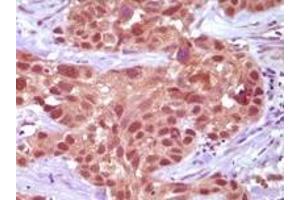 Immunohistochemistry (IHC) image for anti-Mismatch Repair Protein 2 (MSH2) antibody (ABIN2464085) (MSH2 抗体)