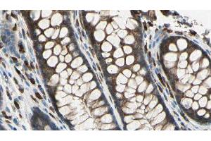 ABIN6278833 at 1/100 staining Rat colon tissue by IHC-P. (SAG 抗体  (Internal Region))