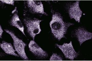 Immunofluorescent staining of EaHy cells. (SRPK1 抗体  (AA 312-434))