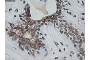 Immunohistochemical staining of paraffin-embedded breast using anti-KRT18 (ABIN2452646) mouse monoclonal antibody. (Cytokeratin 18 抗体  (AA 69-372))