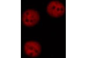 DF6176 staining HEPG2 cells by ICC/IF. (RAD50 抗体  (Internal Region))