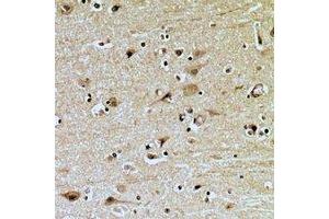 Immunohistochemical analysis of ZNRF2 staining in human brain formalin fixed paraffin embedded tissue section. (ZNRF2 抗体  (C-Term))