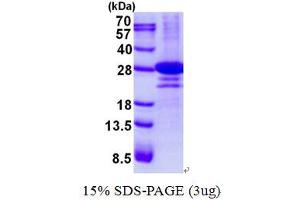 D-Tyrosyl-tRNA Deacylase 1 Homolog (S. Cerevisiae) (DTD1) (AA 1-209) protein (His tag)