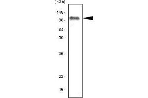 Western Blotting (WB) image for anti-Toll-Like Receptor 7 (TLR7) antibody (ABIN361162) (TLR7 抗体)