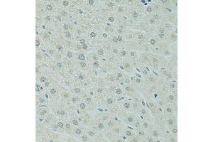 Immunohistochemistry of paraffin-embedded mouse liver using RCC1 antibody. (RCC1 抗体  (AA 1-240))
