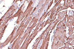 Immunohistochemistry of paraffin-embedded rat heart using Tropomyosin 1 Rabbit mAb (ABIN7271013) at dilution of 1:100 (40x lens). (Tropomyosin 抗体)