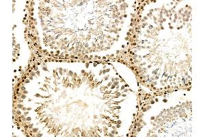 ABIN6258705 and ABIN6274437 at 1/100 staining Rat testis tissue by IHC-P.