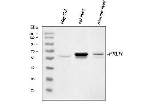 Western blot analysis of PKLR using anti-PKLR antibody (ABIN3043607).