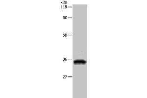 Western Blot analysis of 293T cell using UPK3B Polyclonal Antibody at dilution of 1:1000 (Uroplakin 3B 抗体)