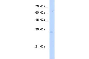 PPA1 antibody used at 5 ug/ml to detect target protein. (Pyrophosphatase (Inorganic) 1 (PPA1) 抗体)