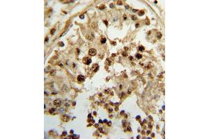 Formalin-fixed and paraffin-embedded human testis tissue reacted with HSD17B3 Antibody (Center), which was peroxidase-conjugated to the secondary antibody, followed by DAB staining. (HSD17B3 抗体  (AA 89-118))