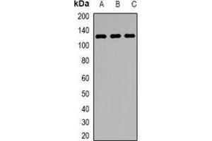 Western blot analysis of KDM1A expression in Jurkat (A), MCF7 (B), mouse testis (C) whole cell lysates. (LSD1 抗体)
