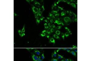 Immunofluorescence analysis of U2OS cells using TSHB Polyclonal Antibody (TSHB 抗体)