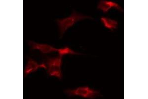 ABIN6275544 staining Hela by IF/ICC. (VRK2 抗体  (Internal Region))