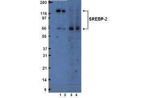 Western Blotting (WB) image for anti-Sterol Regulatory Element Binding Transcription Factor 2 (SREBF2) (AA 833-1141) antibody (ABIN967564) (SREBF2 抗体  (AA 833-1141))