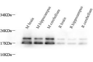 Western Blot analysis of various samples using MBP Polyclonal Antibody at dilution of 1:1000. (MBP 抗体)