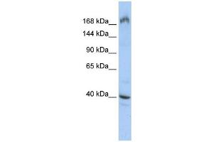 EIF4G1 antibody used at 1 ug/ml to detect target protein. (EIF4G1 抗体  (Middle Region))