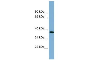 WB Suggested Anti-XAF1 Antibody Titration: 0. (XAF1 抗体  (Middle Region))