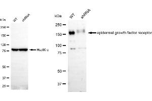 Western blotting analysis using EGFR antibody (ABIN7798479).