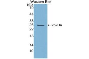 Western blot analysis of the recombinant protein. (Emilin1 抗体  (AA 806-1016))