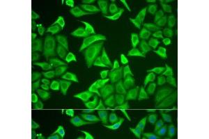 Immunofluorescence analysis of U2OS cells using NGB Polyclonal Antibody (Neuroglobin 抗体)