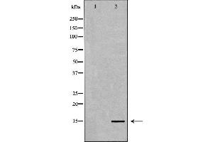 Western blot analysis of extracts of HeLa, using Histone H3K4me3 Antibody. (Histone 3 抗体  (H3K4me3))