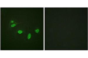 Immunofluorescence staining of methanol-fixed HeLa cells using ETS1 (Phospho-Thr38) Antibody. (ETS1 抗体  (pThr38))