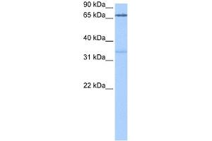 Western Blotting (WB) image for anti-Peptidyl Arginine Deiminase, Type II (PADI2) (Middle Region) antibody (ABIN2784886)