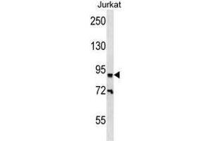 ZNF780B Antibody (N-term) western blot analysis in Jurkat cell line lysates (35 µg/lane). (ZNF780B 抗体  (N-Term))