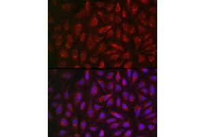 Immunofluorescence analysis of U2OS cells using  Rabbit pAb (ABIN3021778, ABIN3021779, ABIN3021780, ABIN1512563 and ABIN6215865) at dilution of 1:200 (40x lens). (ALDH2 抗体  (AA 1-380))