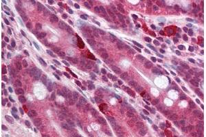 Human Small Intestine (formalin-fixed, paraffin-embedded) stained with MC4R antibody ABIN214186 at 5 ug/ml followed by biotinylated goat anti-rabbit IgG secondary antibody ABIN481713, alkaline phosphatase-streptavidin and chromogen. (MC4R 抗体  (AA 21-33))