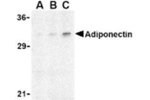 Image no. 1 for anti-Adiponectin (ADIPOQ) (N-Term) antibody (ABIN265161) (ADIPOQ 抗体  (N-Term))