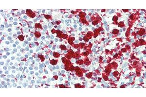 Immunohistochemistry of paraffin-embedded Spleen tissue using CD42b Polyclonal Antibody at dilution of 1:80. (CD42b 抗体)