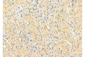 ABIN6264535 and ABIN6273152 at 1/100 staining Rat heart tissue by IHC-P.