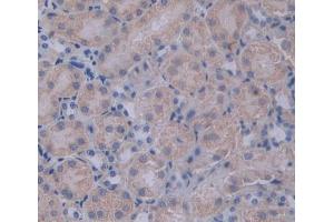 Used in DAB staining on fromalin fixed paraffin- embedded Kidney tissue (PCSK1 抗体  (AA 244-530))