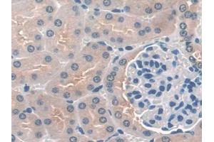 DAB staining on IHC-P; Samples: Mouse Kidney Tissue (DC-SIGN/CD209 抗体  (AA 115-238))