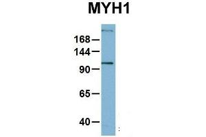 Host:  Rabbit  Target Name:  MYH1  Sample Type:  OVCAR-3  Antibody Dilution:  1. (MYH1 抗体  (N-Term))