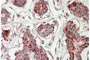 AP21267PU-N ACO2 Antibody staining of paraffin embedded Human Breast at 3. (ACO2 抗体  (Internal Region))