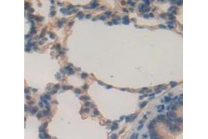 Used in DAB staining on fromalin fixed paraffin- embedded Kidney tissue (MUC5B 抗体  (AA 898-1002))